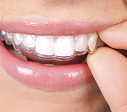 Best Dental Clinic in Trichy