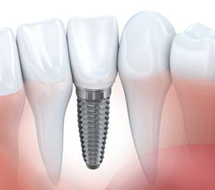 Best Dental Clinic in Trichy