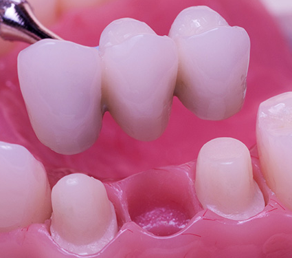 Best Dental Clinic in Trichy