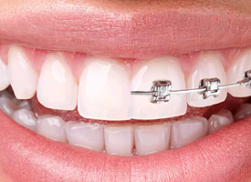 Best Dental Clinic in Trichy