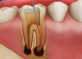 Best Dental Clinic in Trichy