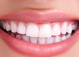 Best Dental Clinic in Trichy