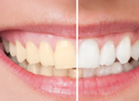 Best Dental Clinic in Trichy